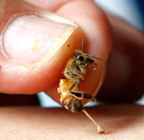 Apitherapy / Bee Venom Therapy